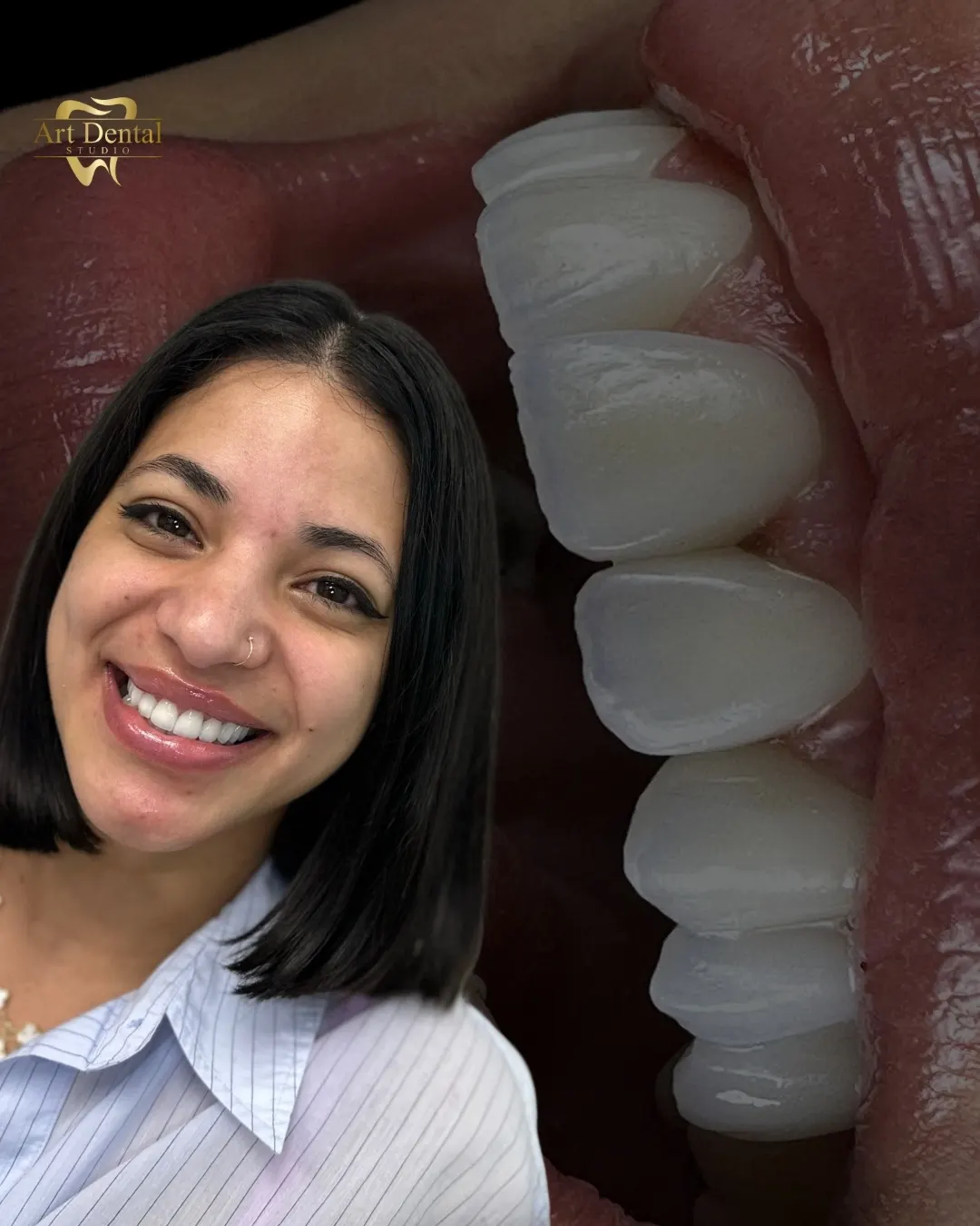 Patient 72: before / after