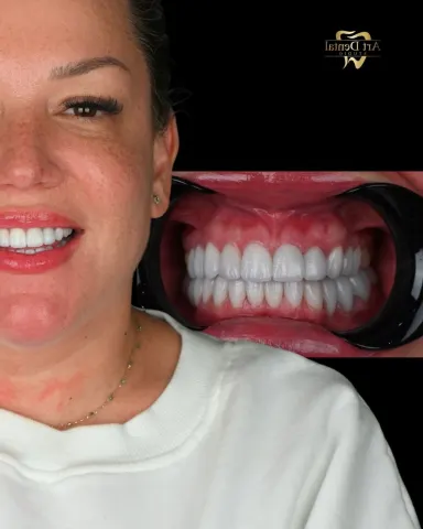 Patient 74, October 17, 2025, photo 4