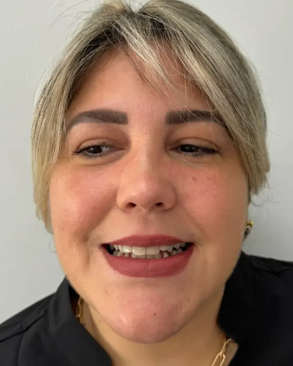 Patient 77, before