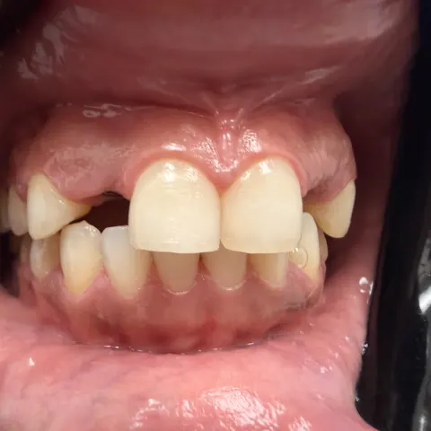 Patient 8, February 2, 2026, photo 5