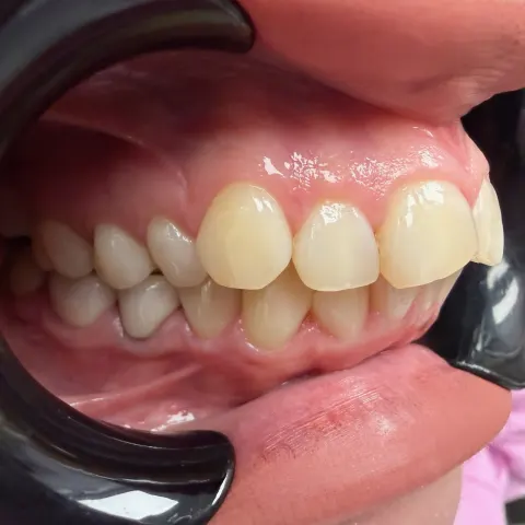 Patient 9, February 5, 2026, photo 22