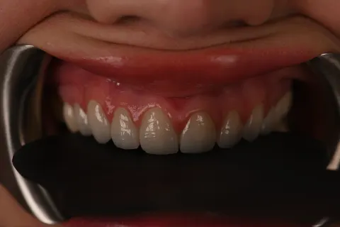 Patient 9, May 4, 2026, photo 30