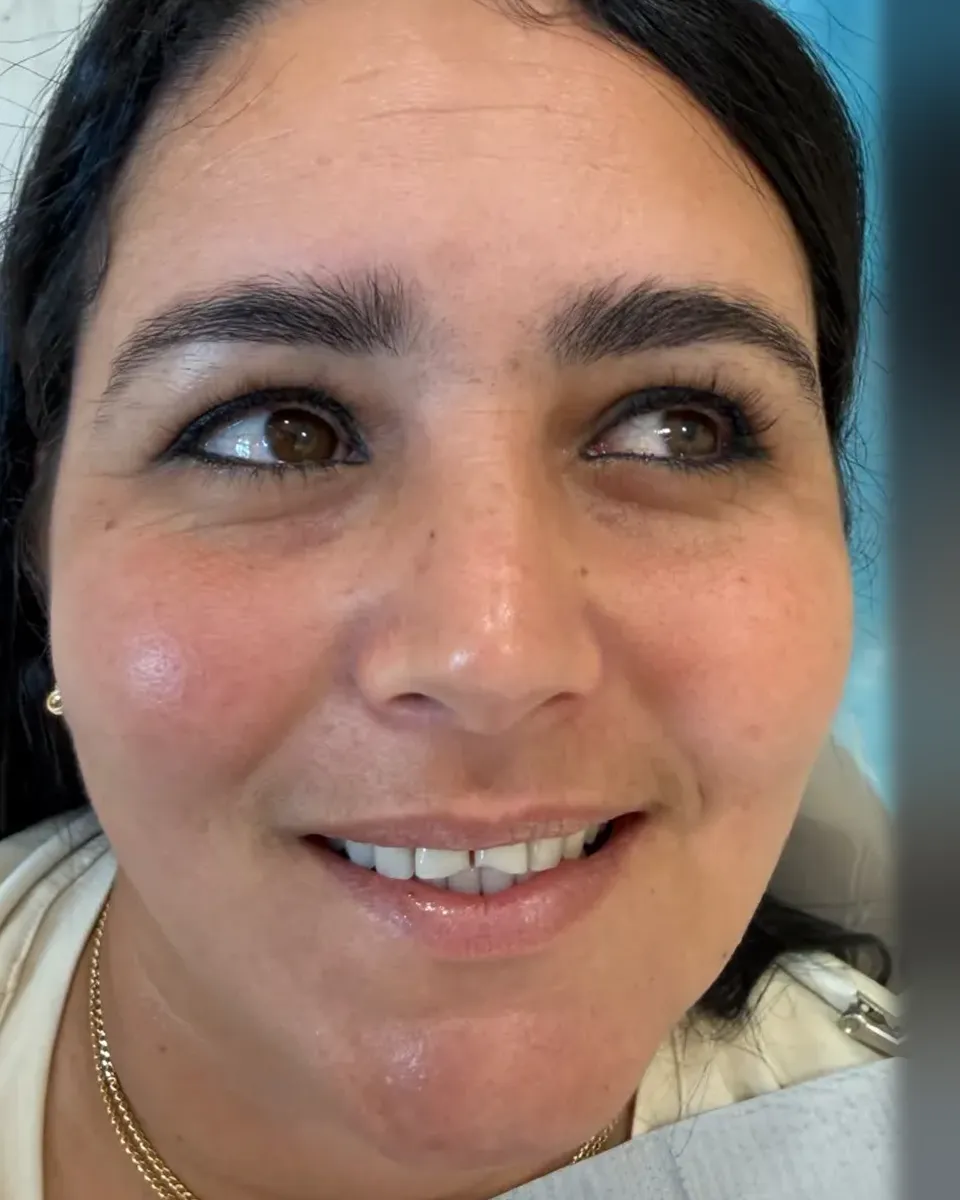 Patient 90, before
