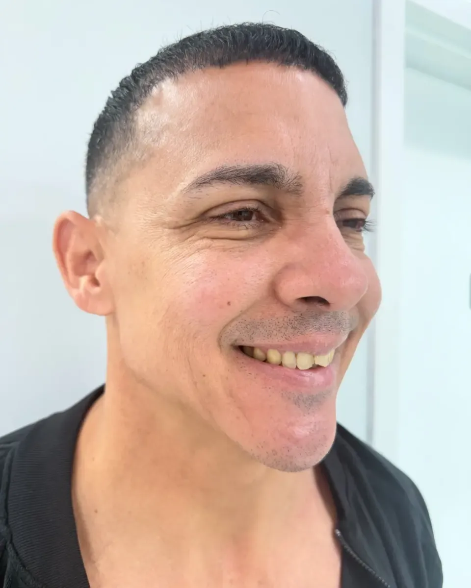Patient 93, before