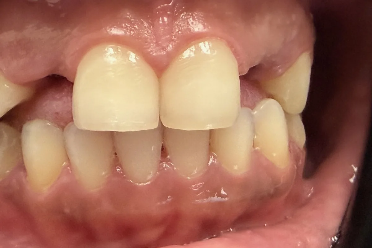 Close-up of a patient's teeth, photographed at Art Dental Studio