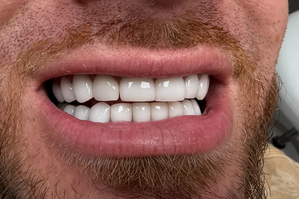 Close-up of a patient's smile, photographed at Art Dental Studio