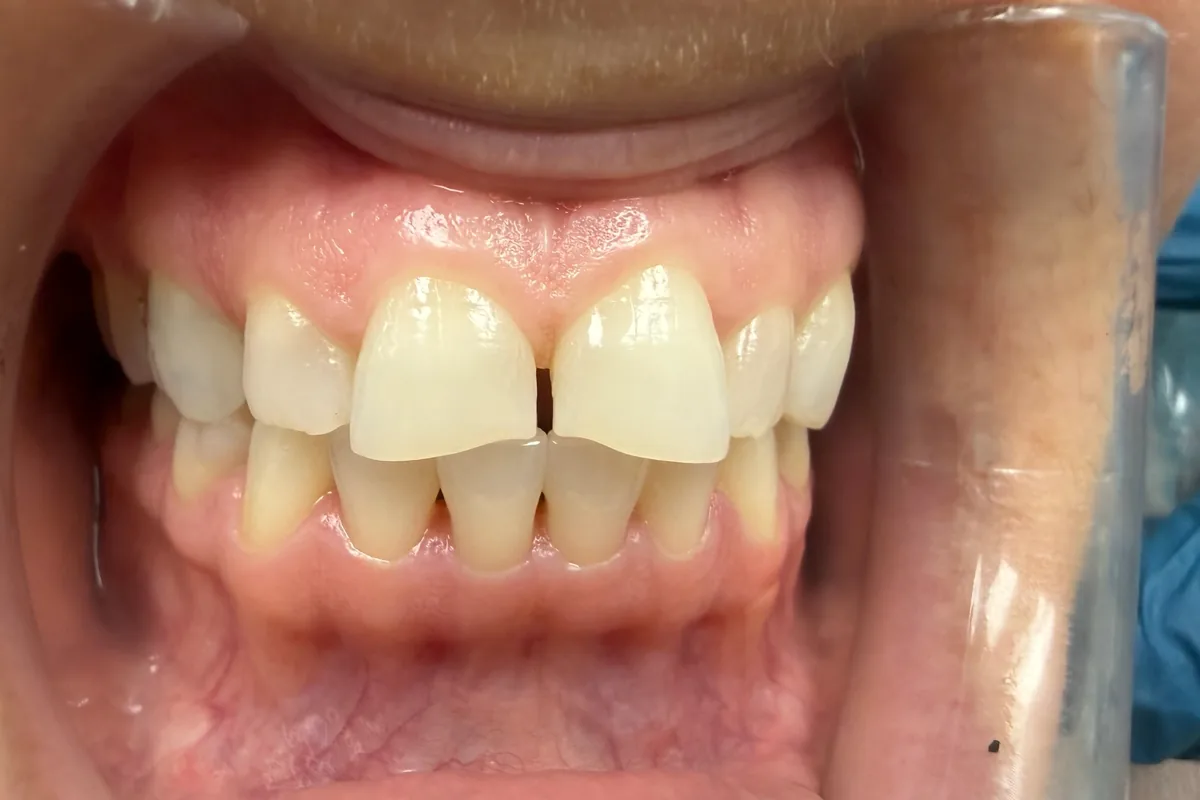 Close-up of a patient's teeth, photographed at Art Dental Studio