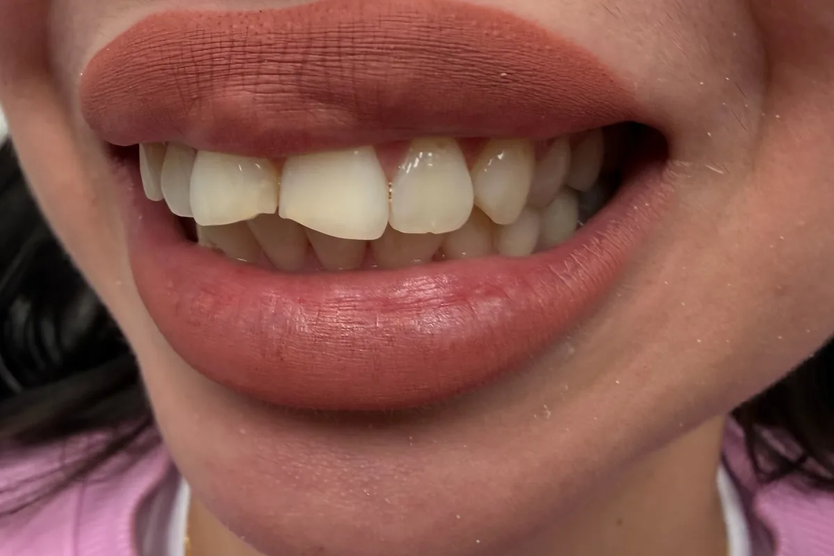 Primer plano de los dientes de un paciente, fotografiados en Art Dental Studio