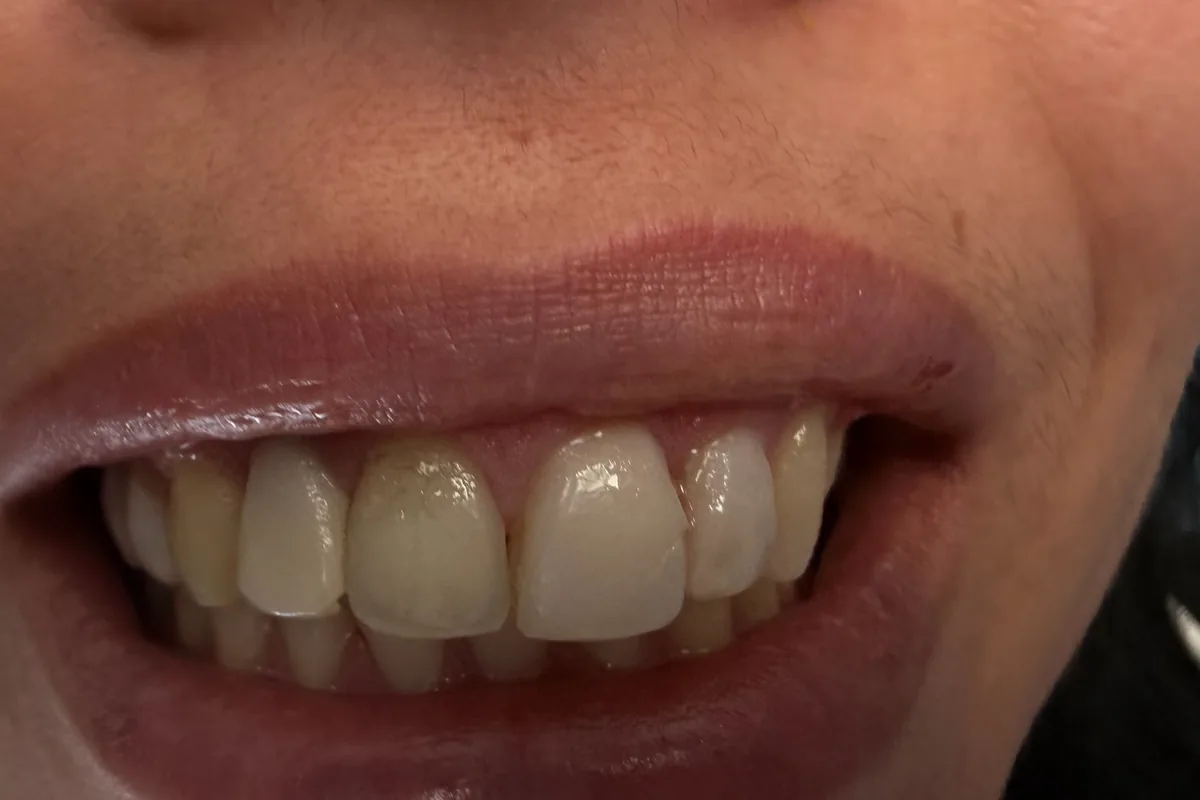 Close-up of a patient's teeth, photographed at Art Dental Studio