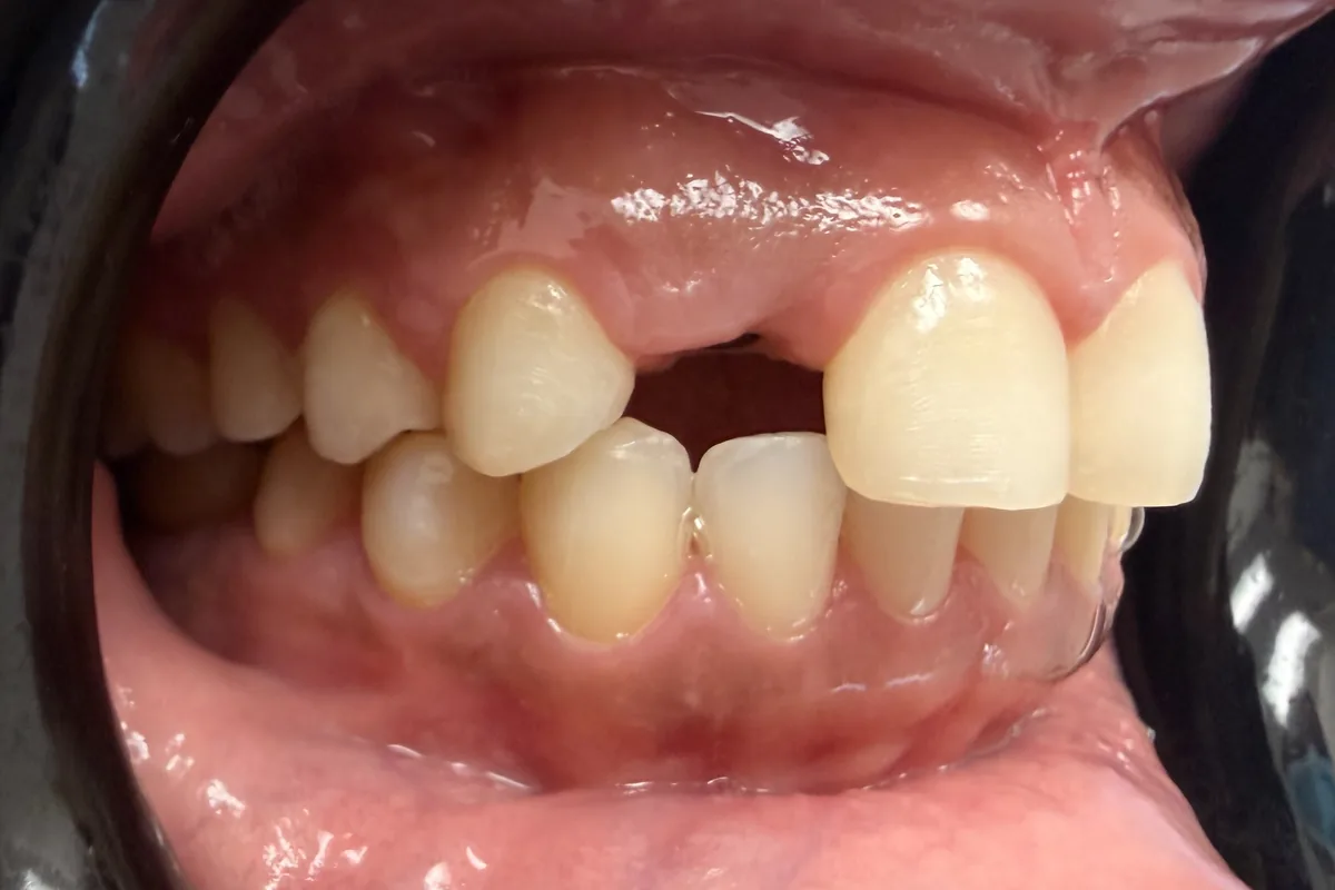 Primer plano de los dientes de un paciente, fotografiados en Art Dental Studio