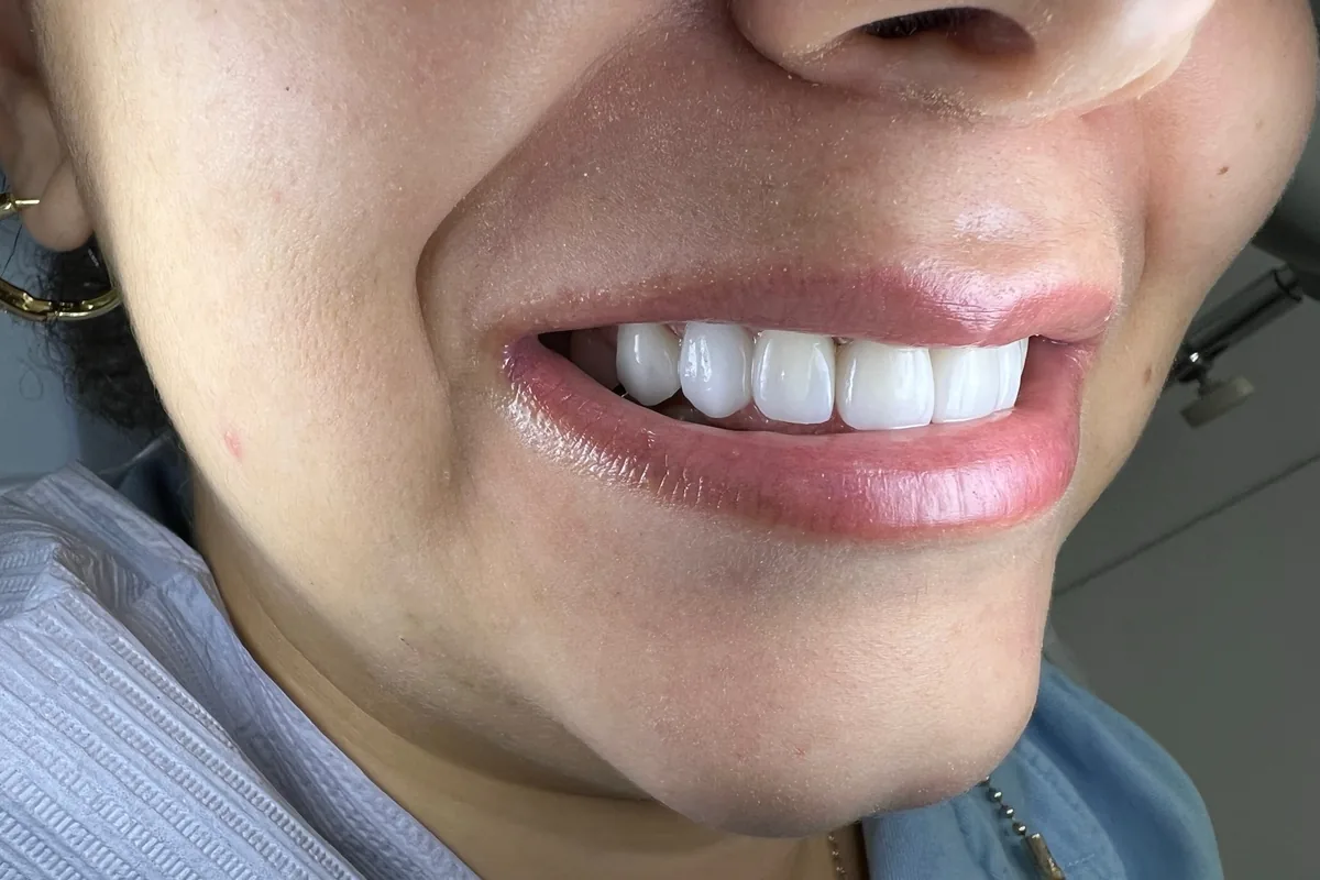Primer plano de la sonrisa de un paciente, fotografiada en Art Dental Studio
