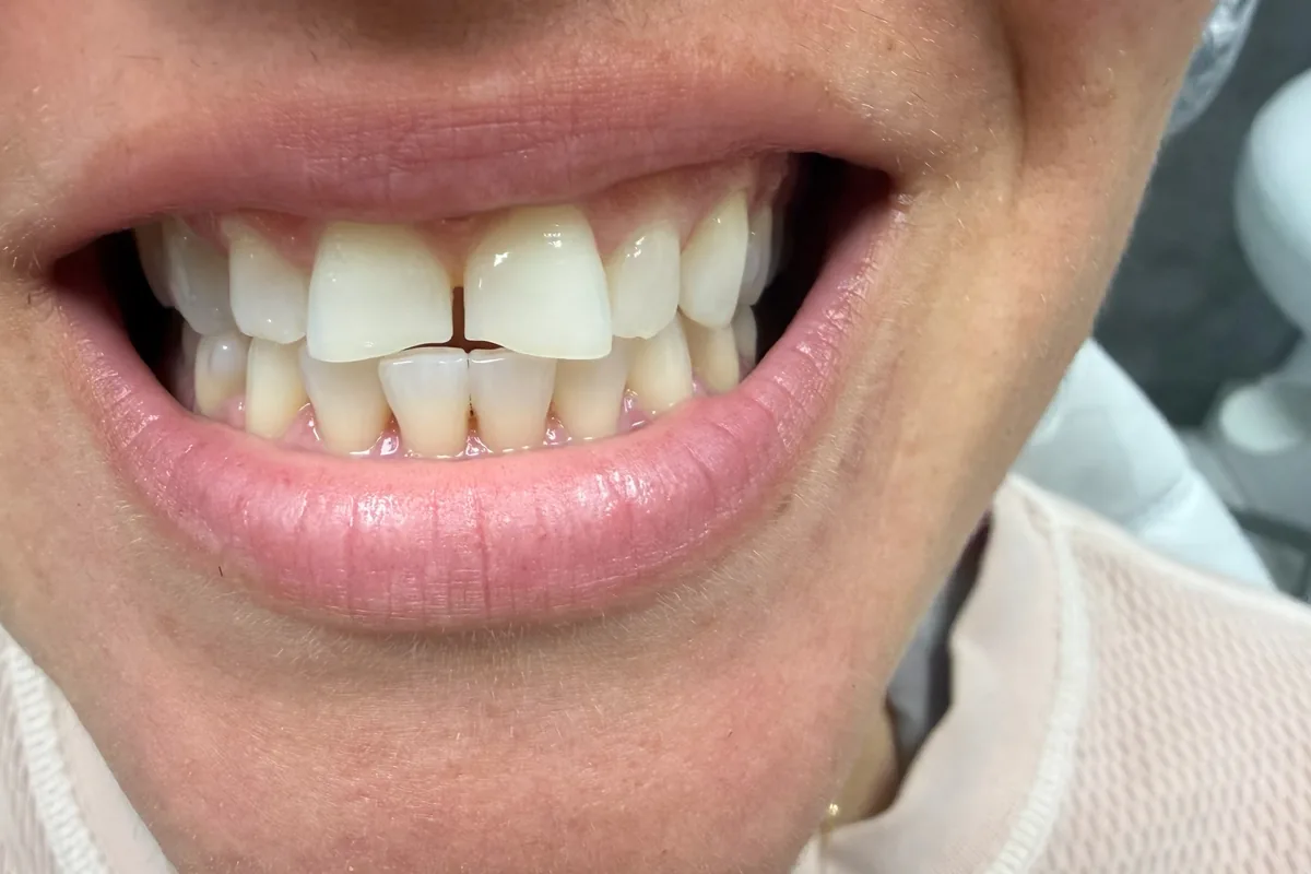 Close-up of a patient's teeth, photographed at Art Dental Studio