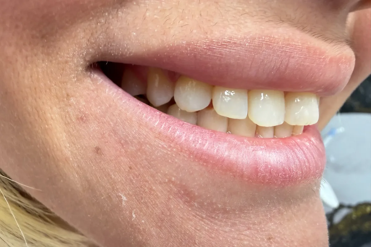 Primer plano de la sonrisa de un paciente, fotografiada en Art Dental Studio