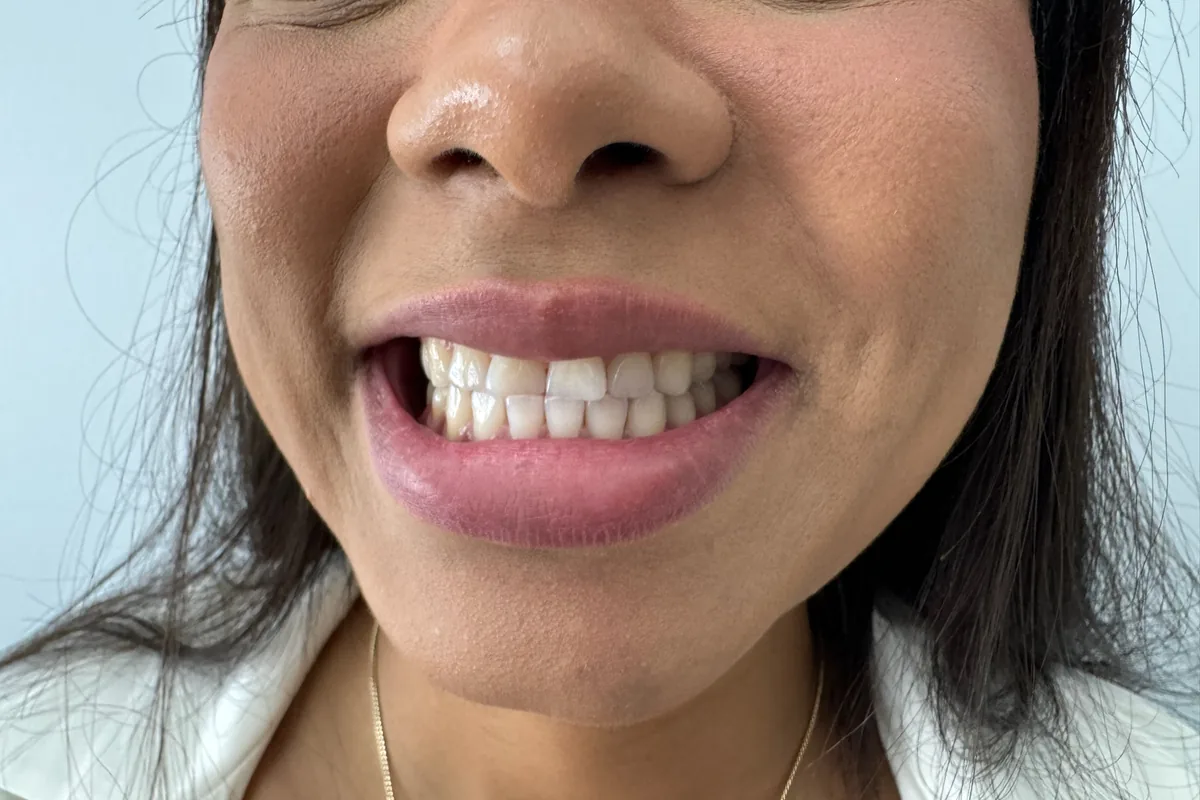Primer plano de la sonrisa de un paciente, fotografiada en Art Dental Studio
