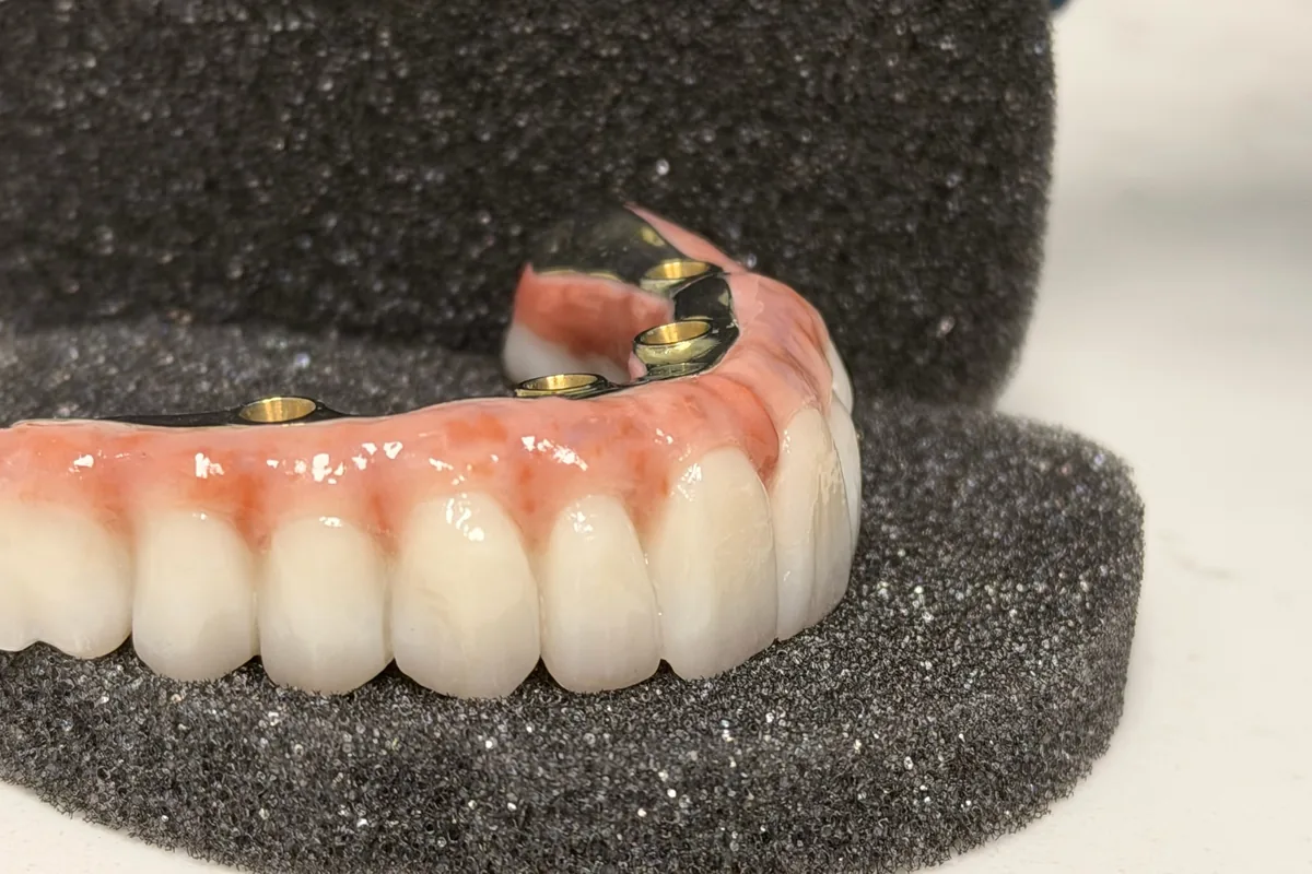 Dental restoration photographed at Art Dental Studio