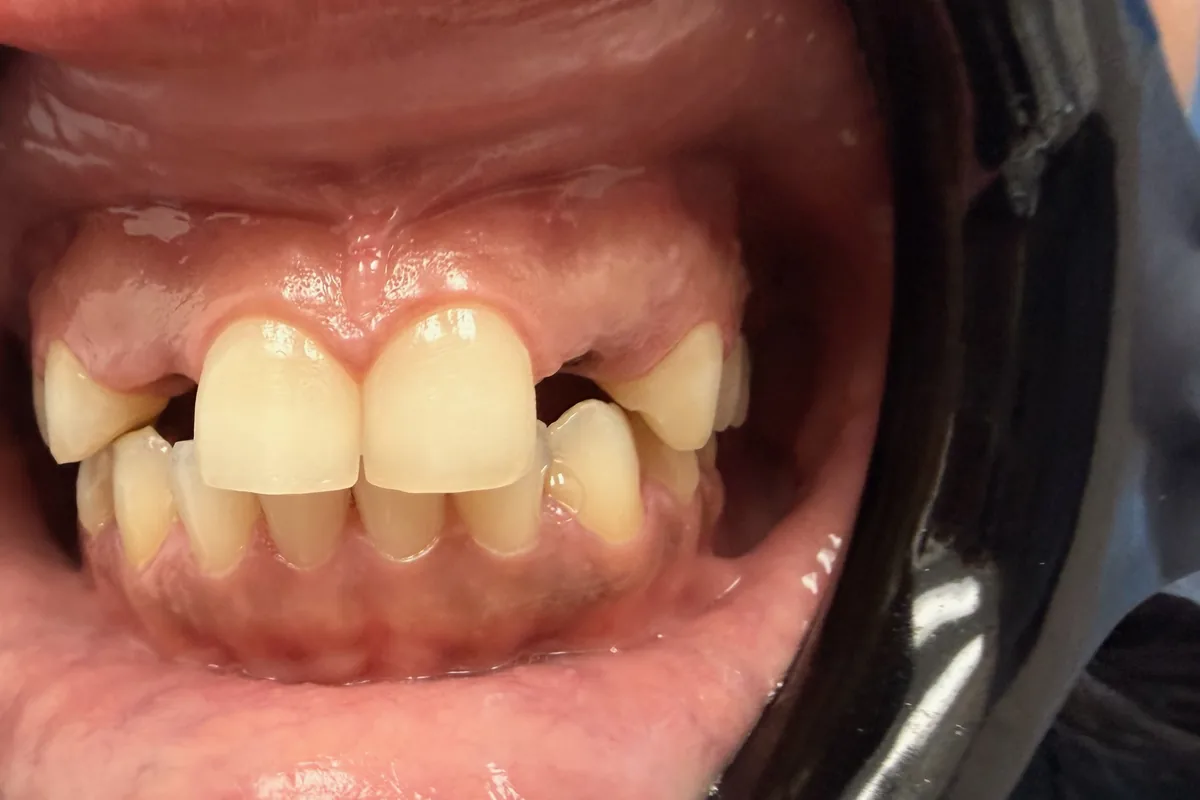 Primer plano de los dientes de un paciente, fotografiados en Art Dental Studio
