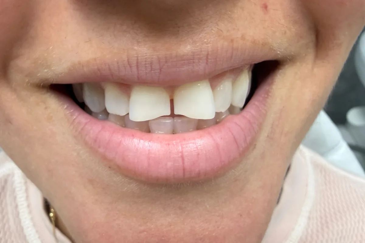 Primer plano de los dientes de un paciente, fotografiados en Art Dental Studio