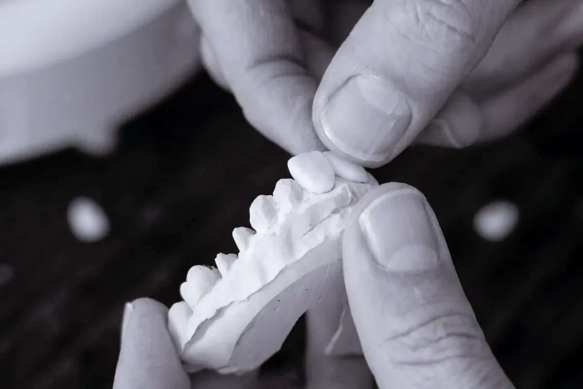 Dental lab work at Art Dental Studio