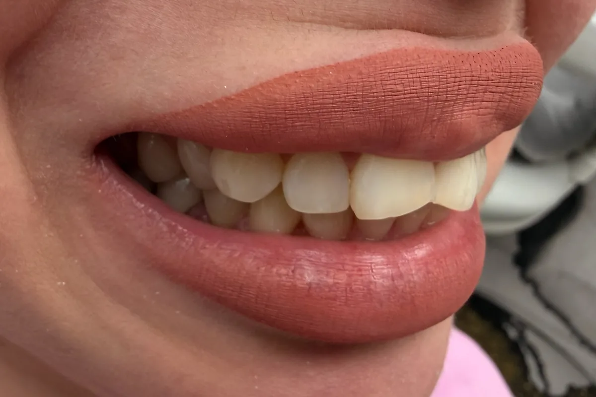 Primer plano de los dientes de un paciente, fotografiados en Art Dental Studio