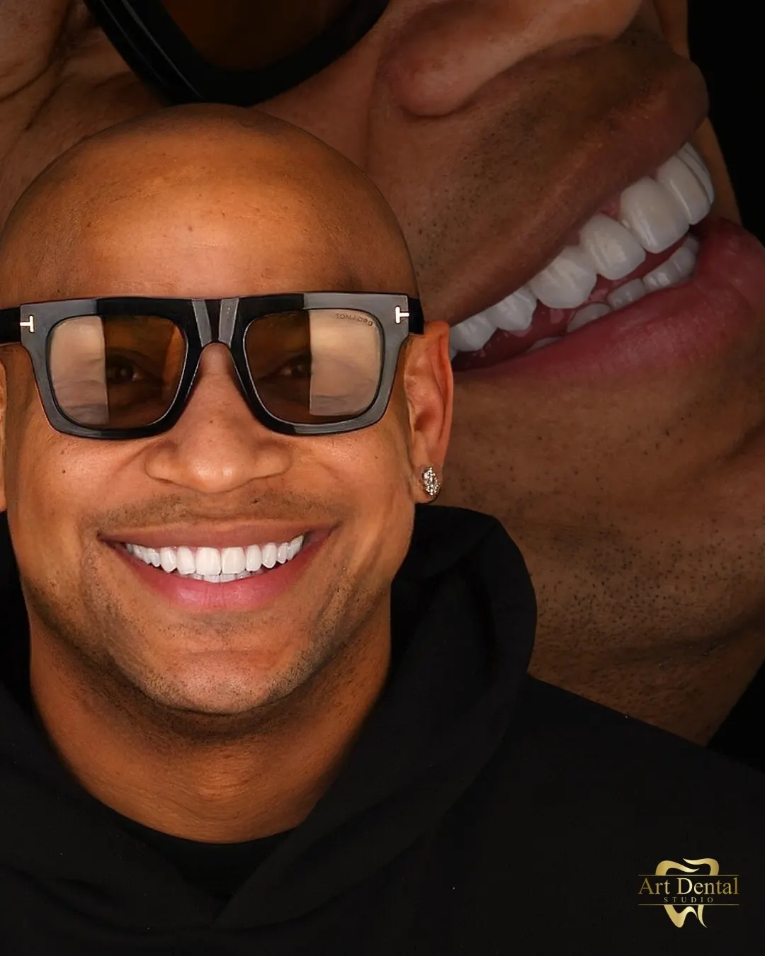Alexander Delgado — Gente de Zona · reggaetón global, Latin Grammy · Art Dental Studio