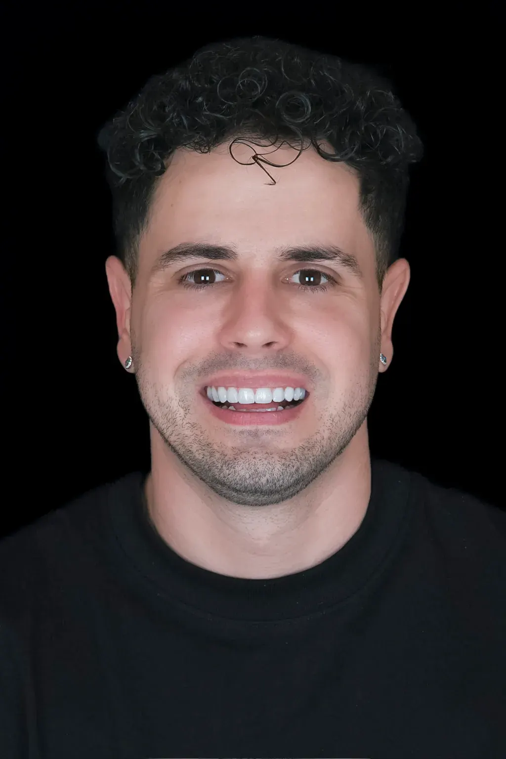 Sonrisa de un paciente de Art Dental Studio tras su tratamiento (8 de 12)