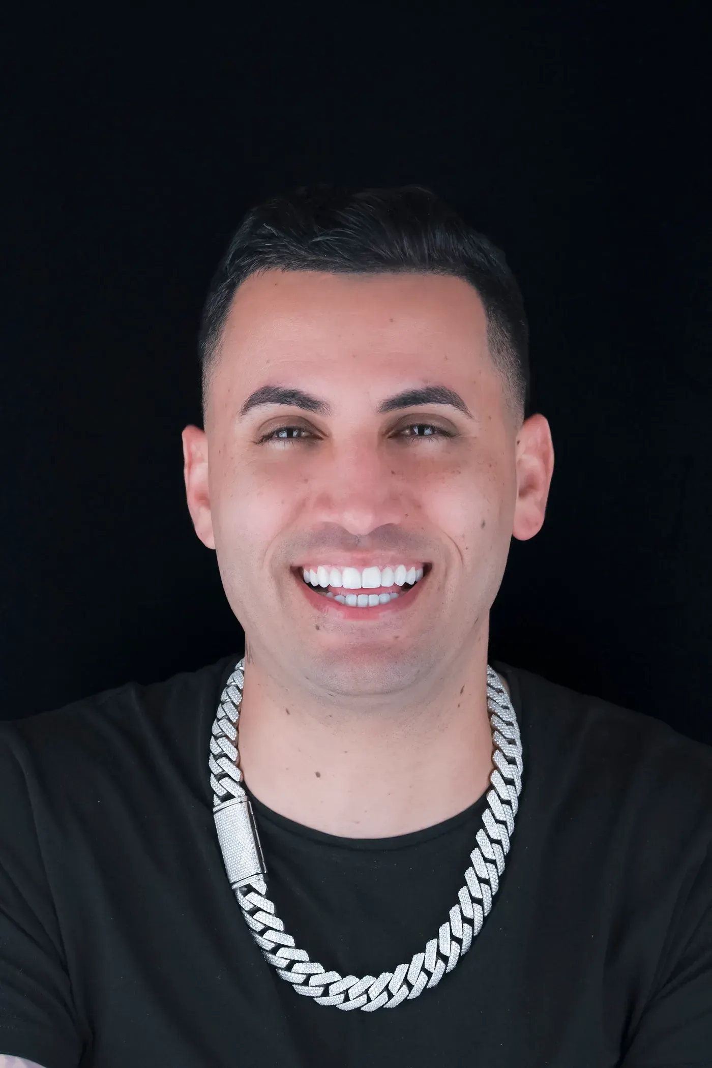 Sonrisa de un paciente de Art Dental Studio tras su tratamiento (10 de 12)
