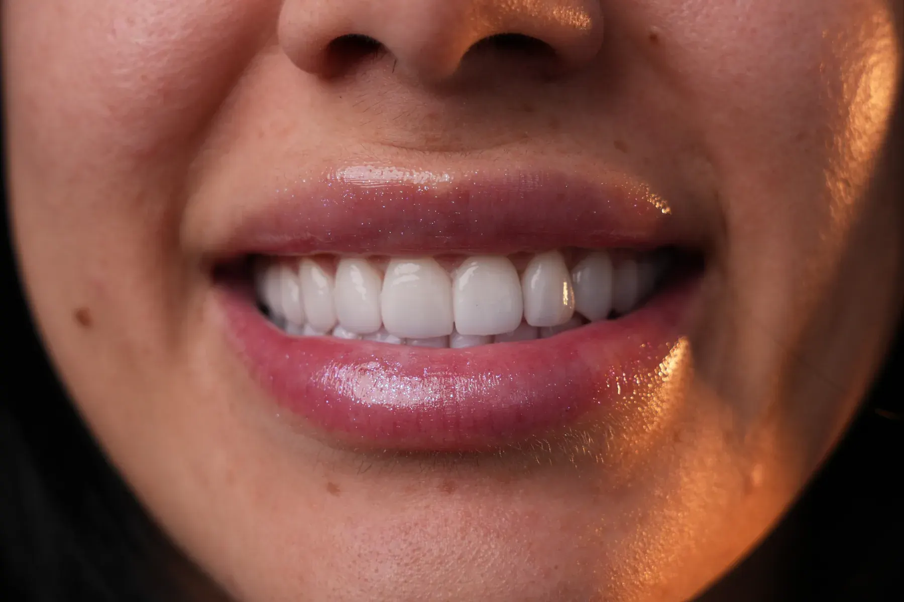 Cosmetic Dentistry — real results