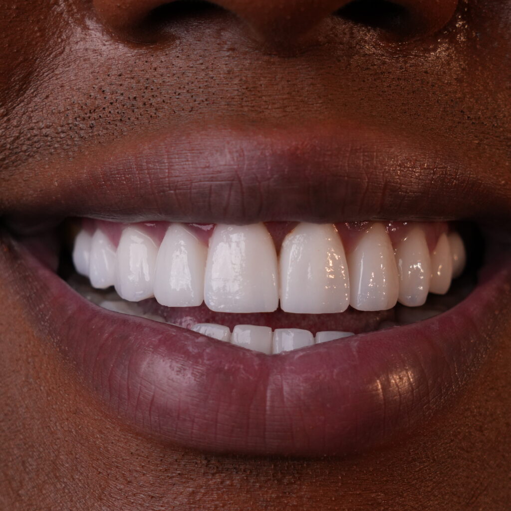 Restorative Dentistry