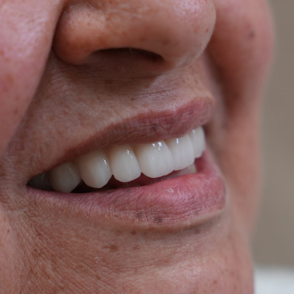 Preventive Dentistry