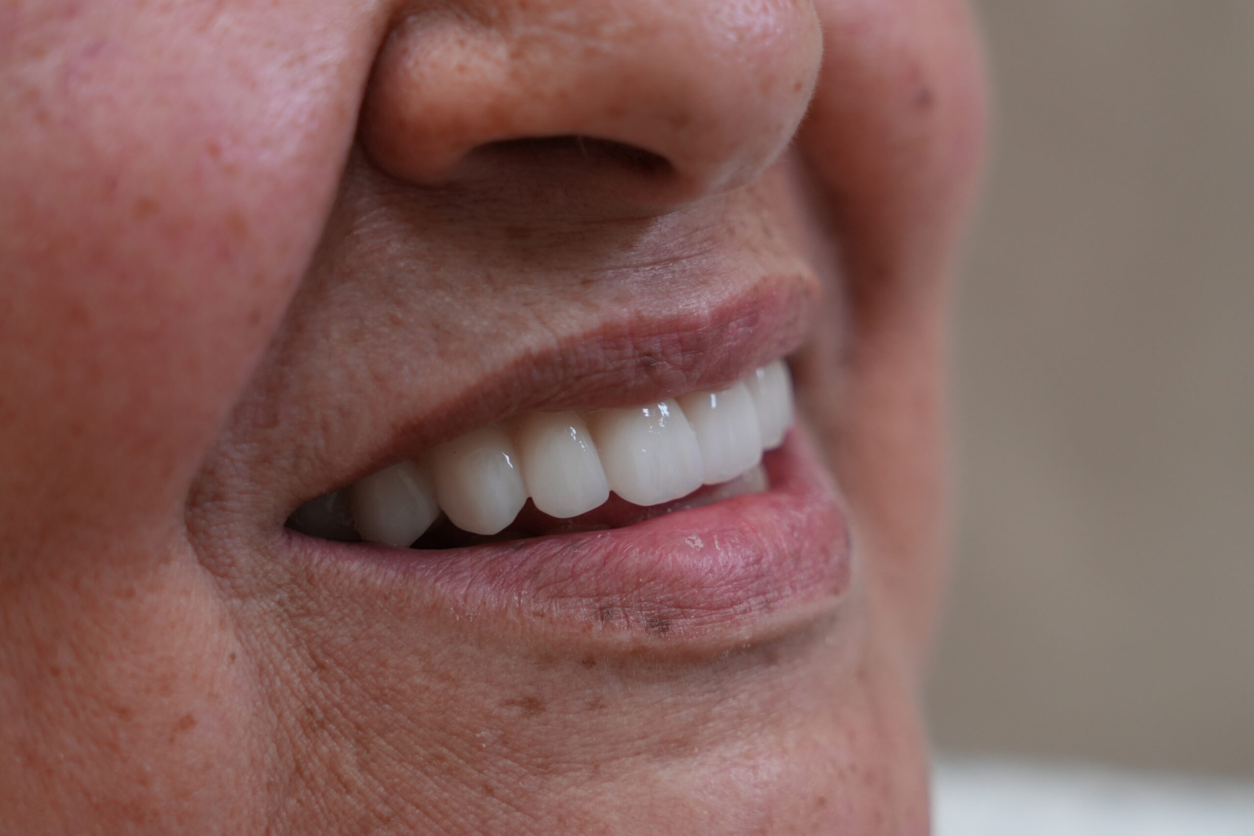 Preventive Dentistry